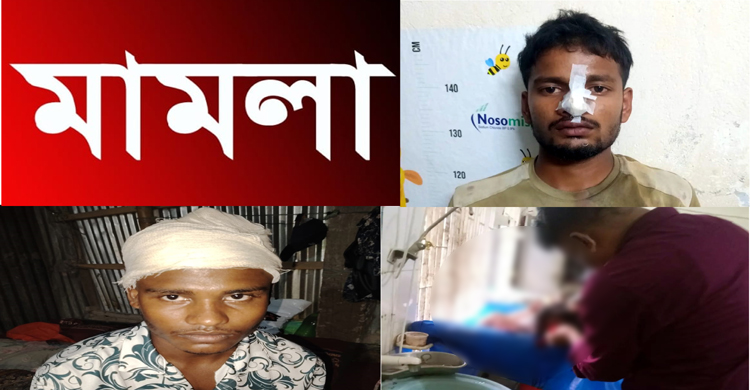 বিশ্বনাথ উপজেলার লামাকাজীতে জোরপূর্বক জায়গা দখলকে কেন্দ্র করার ঘটনায় ধলা মিয়া চেয়ারম্যানের পুত্র সহ ৩৩ জনের বিরুদ্ধে পালটা মামলা